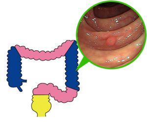 肝臓検査で何がわかるのでしょうか?